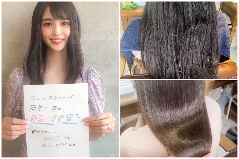 ビフォアフター口コミ写真